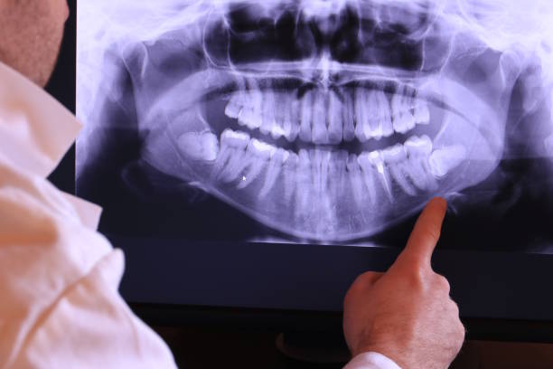 Best Dental Abscess Treatment in Liberty Lake, WA